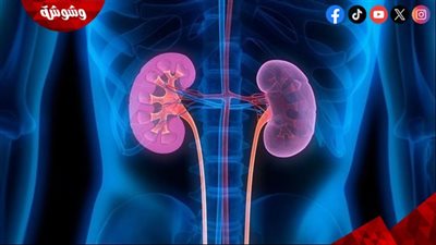 خبراء الصحة: الذكاء الاصطناعي مفتاح تقليل وفيات أمراض الكلى عالميًا