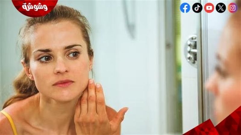 تورم الوجه
