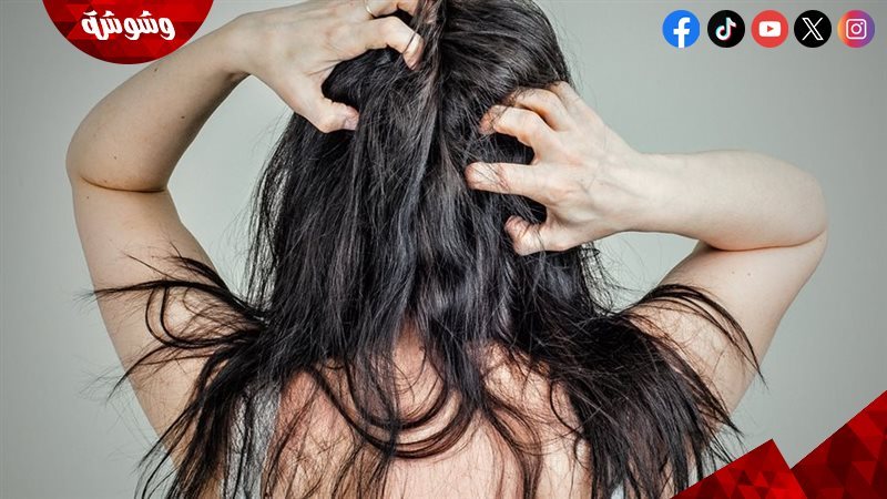 مشاكل فروة الرأس