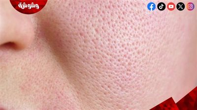أسباب ظهور المسامات الواسعة.. حقائق علمية وحلول مجرّبة
