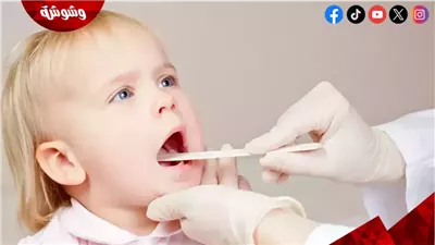لماذا يصاب الأطفال بالتهاب اللوزتين؟.. تفاصيل