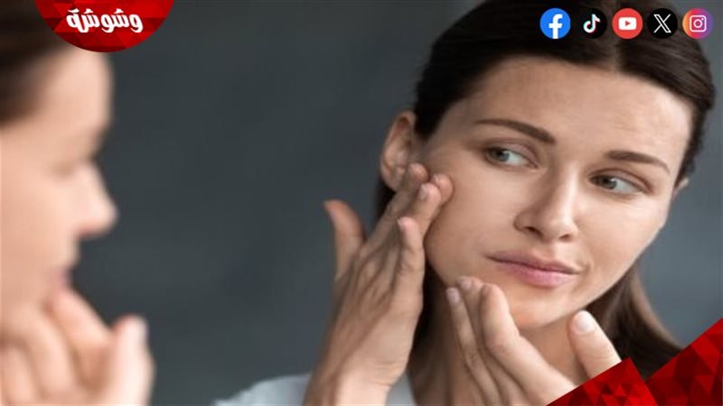 البشرة بعد الولادة
