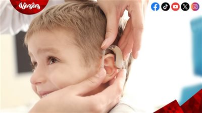 طفرة صحية غير مسبوقة.. زراعة قوقعة مجانية بأكثر من مليون جنيه لـ2000 طفل سنويًا