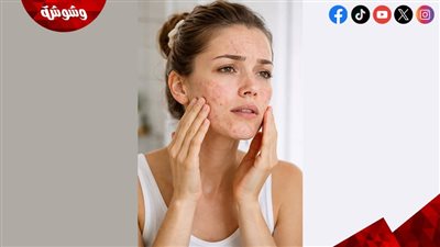 سر التخلص من حب الشباب.. لماذا يوصي الخبراء بالمرطب كخطوة علاجية؟