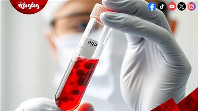 لماذا يتساقط شعركِ بغزارة؟.. 5 تحاليل طبية تكشف السر