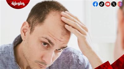 علاج جديد لتساقط الشعر.. نتائج واعدة تعيد الأمل للرجال