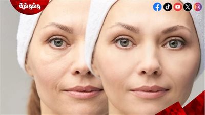أسباب انتفاخ الوجه صباحًا وطرق التخلص منه 