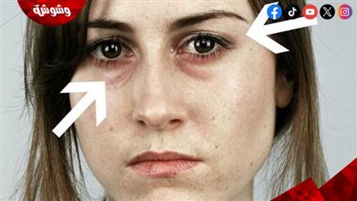 أسباب شحوب البشرة المفاجئ وكيف تستعيدين نضارتك بسرعة