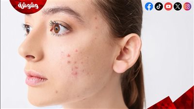 أخطاء يومية في تنظيف البشرة قد تسبب الحبوب دون أن تنتبهي