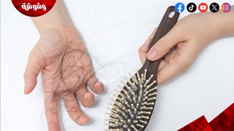 تساقط الشعر الموسمي