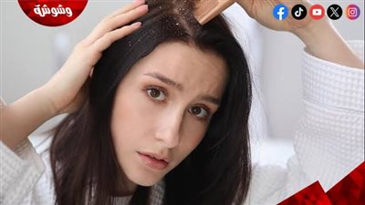 طرق فعالة للتخلص من قشرة الشعر.. وصفات طبيعية ونصائح تمنحك فروة رأس صحية