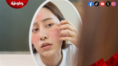 تغيرات بسيطة في البشرة تكشف عن اضطراب الهرمونات لدى النساء