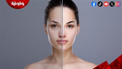وصفات طبيعية لتوحيد لون البشرة.. حلول منزلية لبشرة صافية ومشرقة