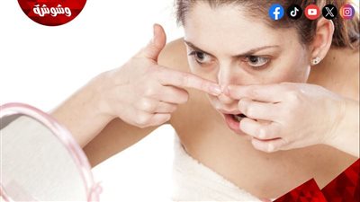 تخلصي من الرؤوس السوداء بوصفة منزلية سهلة