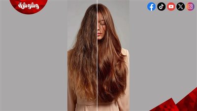 هل تغير ملمس شعرك فجأة؟.. إليك الأسباب الطبية والحلول