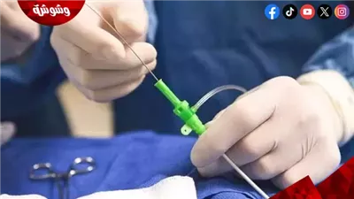 15 ألف قسطرة قلب للكبار.. الكشف عن تطور خدمات القلب تحت مظلة التأمين الشامل